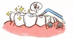 牙齒保健塗氟活動